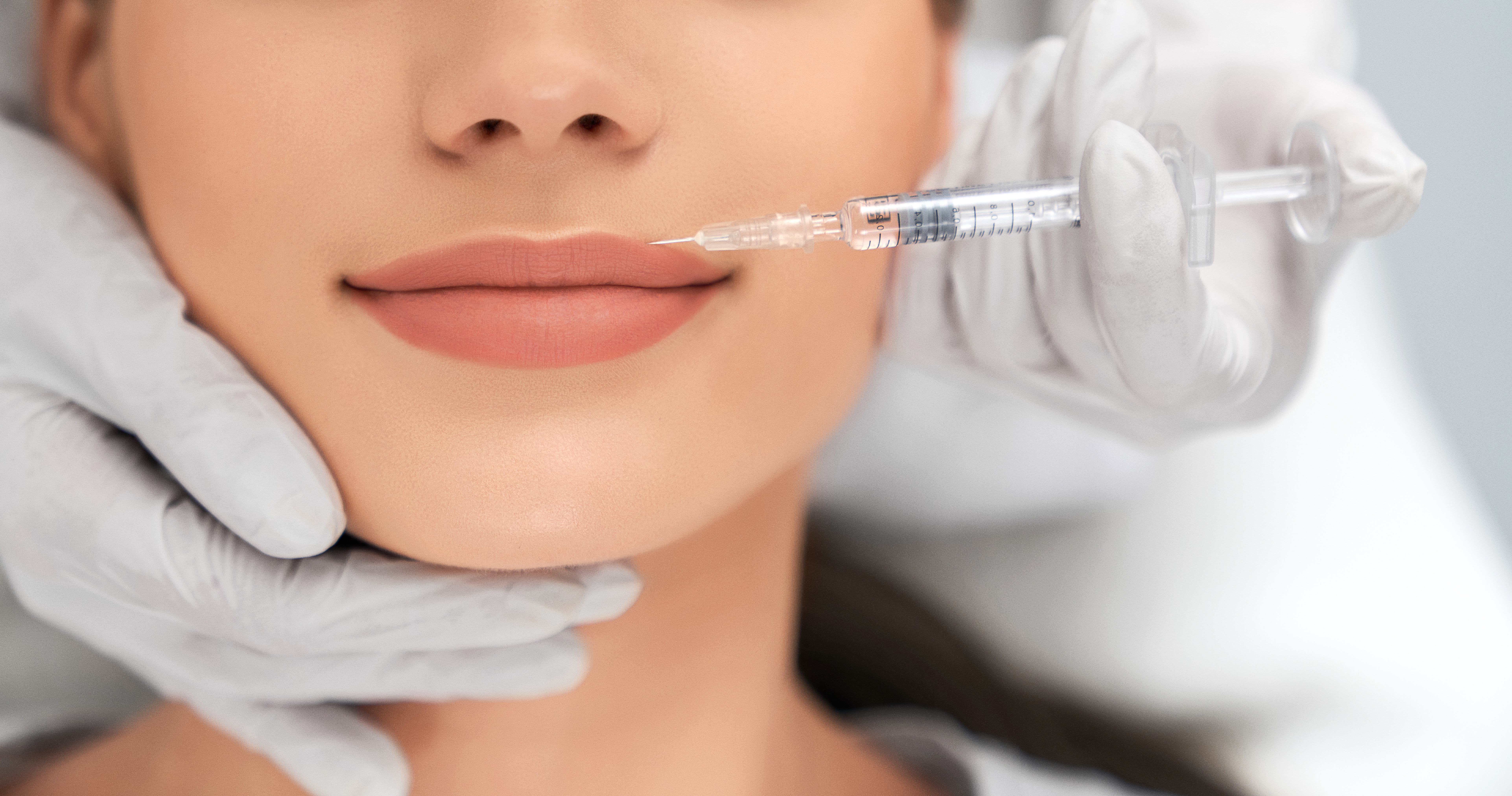 dermal filler for plump lips