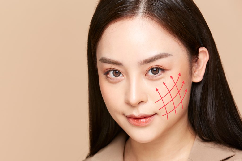 What is Thread Lift? Best Aesthetic Clinic Malaysia Aesthetic Clinic Kuala Lumpur